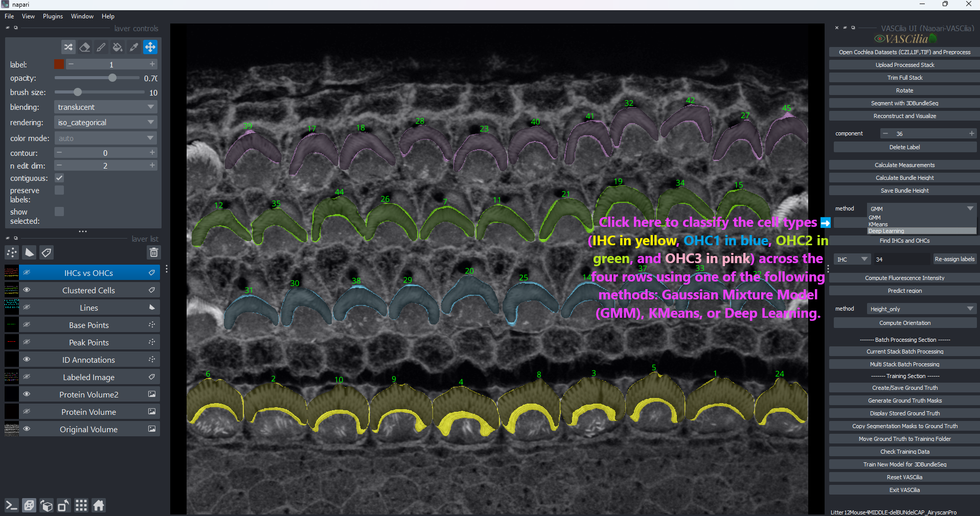 identify cell type Action Preprocessing Example