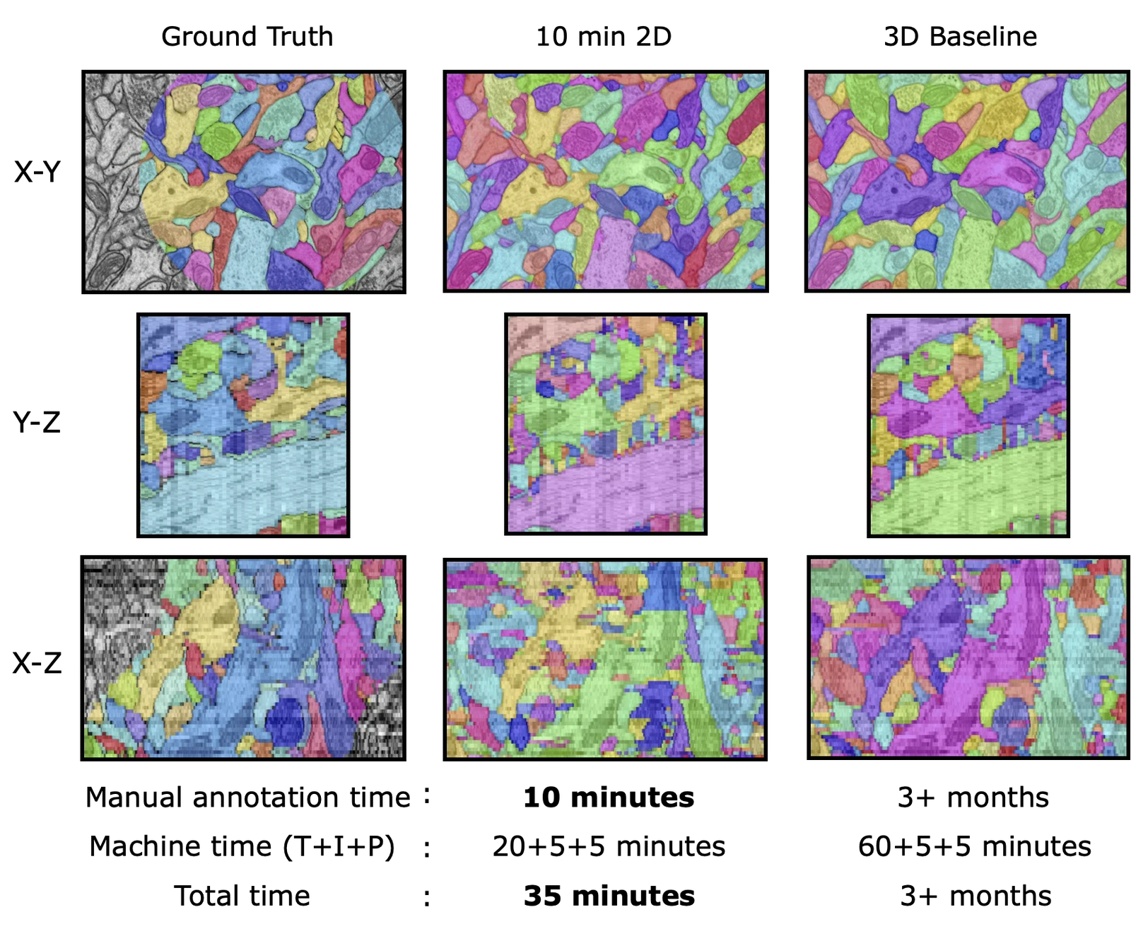 Orthogonal views comparing 2D to 3D result with 10 minutes of sparse annotation, 3D Baseline result with all dense annotations, and ground-truth.