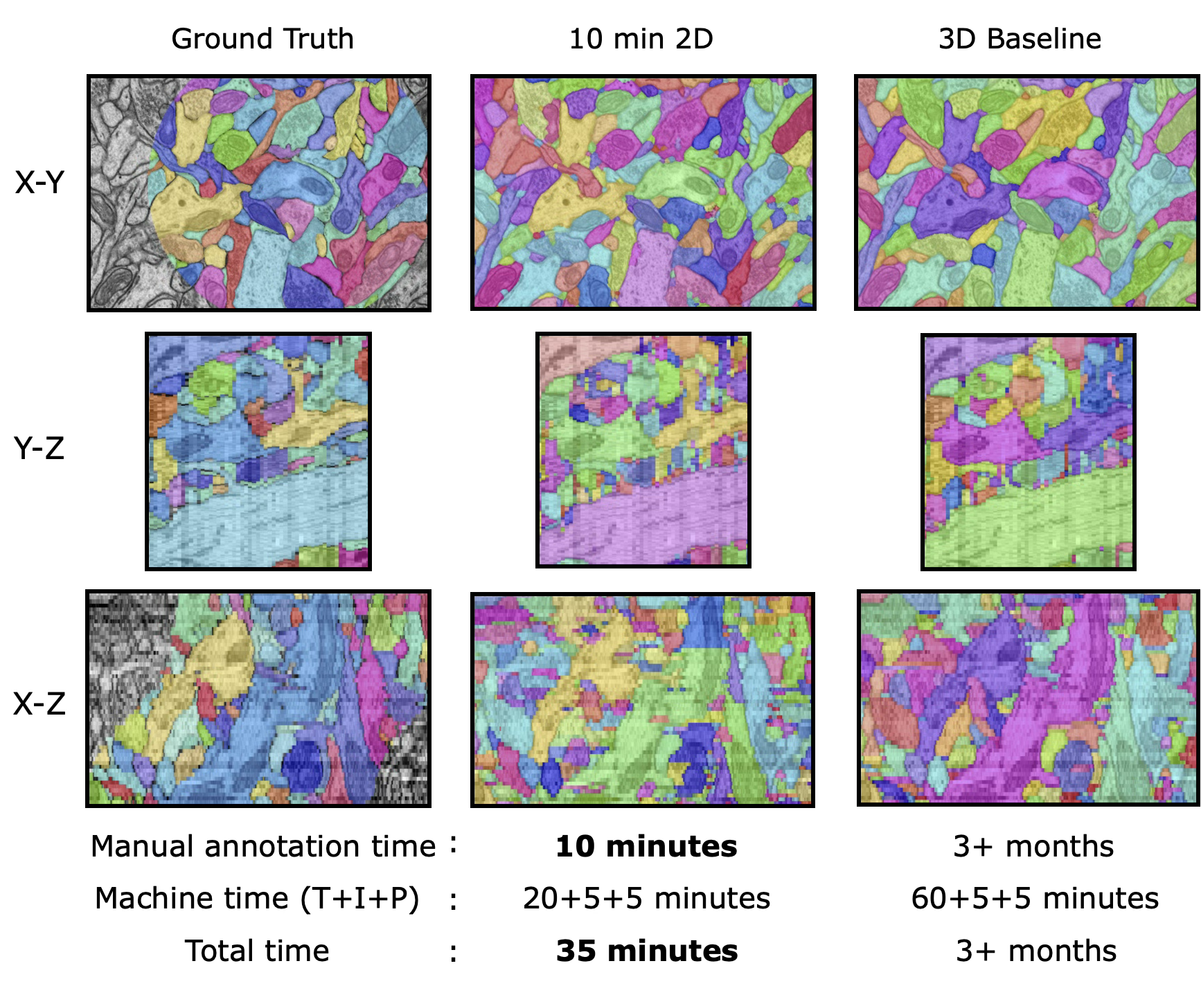 Orthogonal views comparing 2D to 3D result with 10 minutes of sparse annotation, 3D Baseline result with all dense annotations, and ground-truth.